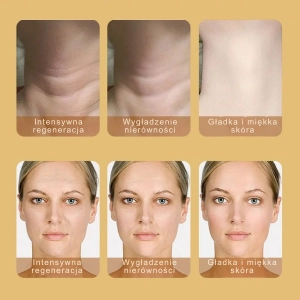 Efekty stosowania BAFFS Neck Therapy Wand – wygładzenie zmarszczek na szyi, poprawa napięcia skóry i regeneracja twarzy po regularnym masażu EMS i LED